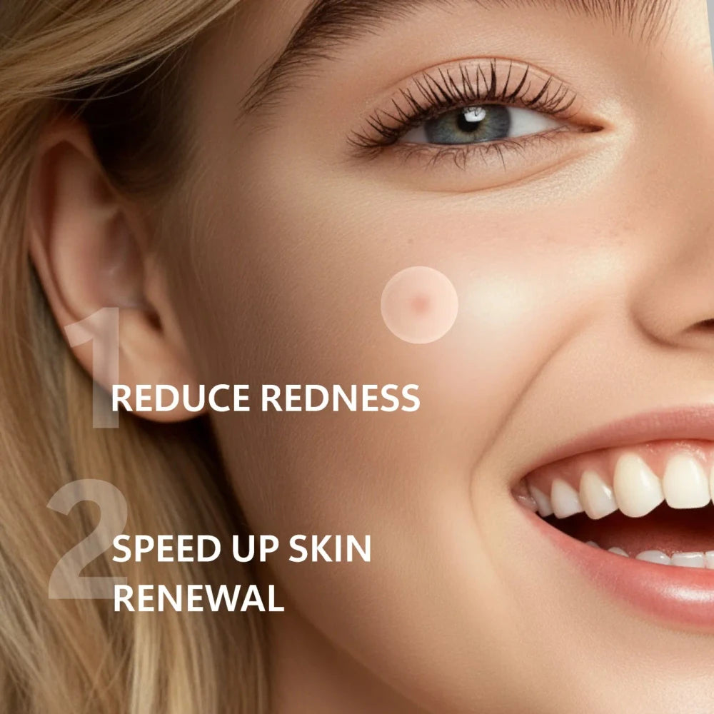 Overnight Micro-Dart Acne Patches