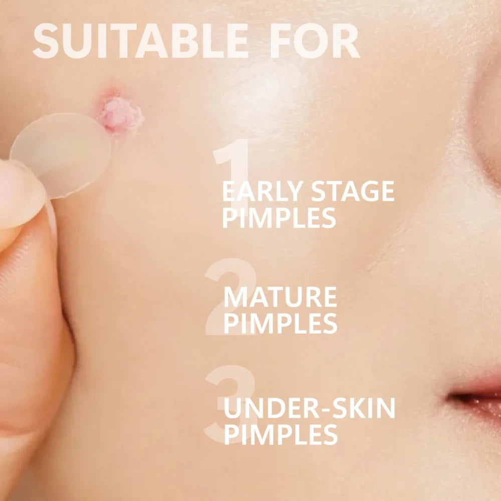Overnight Micro-Dart Acne Patches